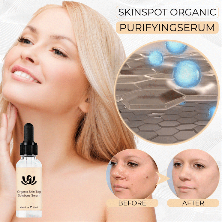 Organic Skin Tag Solution Serum